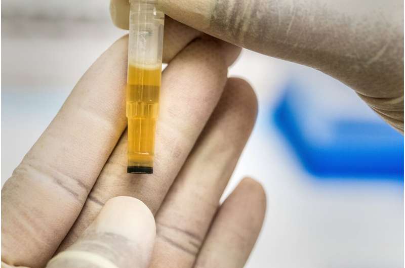 urine test