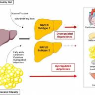 Non-alcoholic fatty liver disease: Hepatokines mediate its impact on metabolic diseases and help to identify subtypes