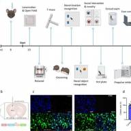 Researchers discover crucial role of brain's striatum cilia in time perception